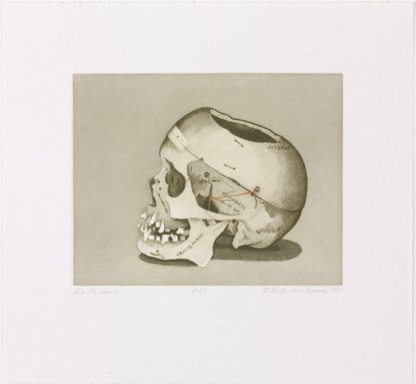 DR. R.'S SKULL (STATE II)