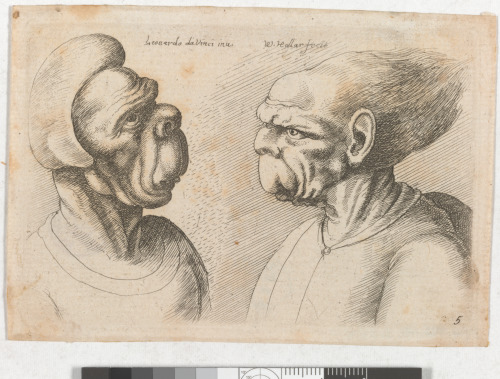 Woman with Huge Upper Lip and Man with Hair Streaming Back