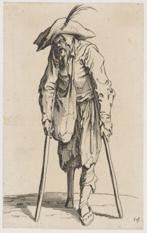 The Beggar with the Wooden Leg
